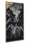 Nežádoucí účinky - Svatá trojice